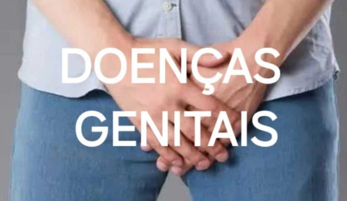 Imagem do tratamento Doenças sexualmente transmissíveis (DST)