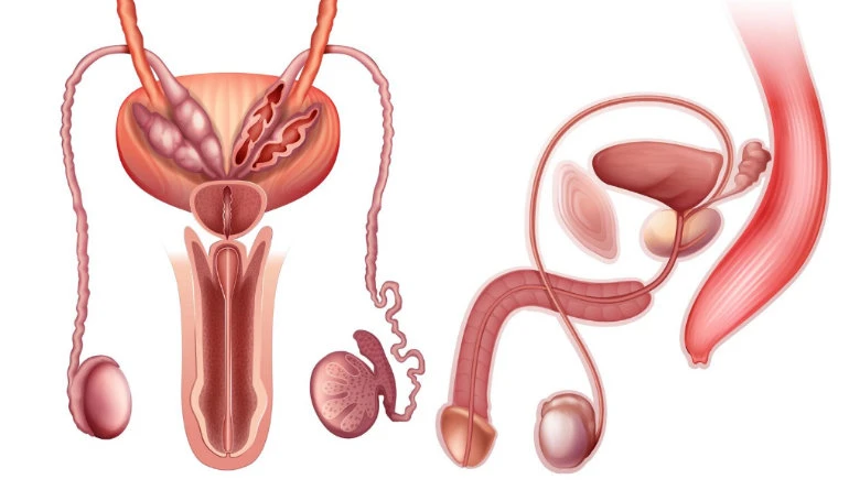 Imagem do tratamento Torção de testículo